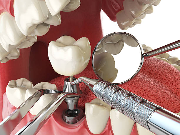 Best Emergency Treatment for Oral Infections in Ravenel, SC